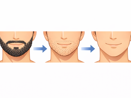 脱毛は都度払いが男性にお得？那覇・浦添で賢く通う方法