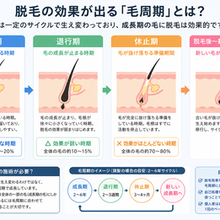 那覇で脱毛は都度払いが正解?男性が損しない選び方ガイド
