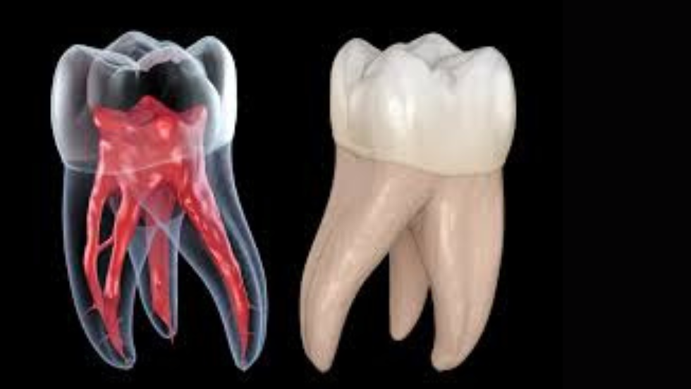 2-Day Hands-On Program in Molar Endodontics