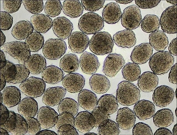 Esferoides celulares visualizados em campo claro [Fonte: Google images]