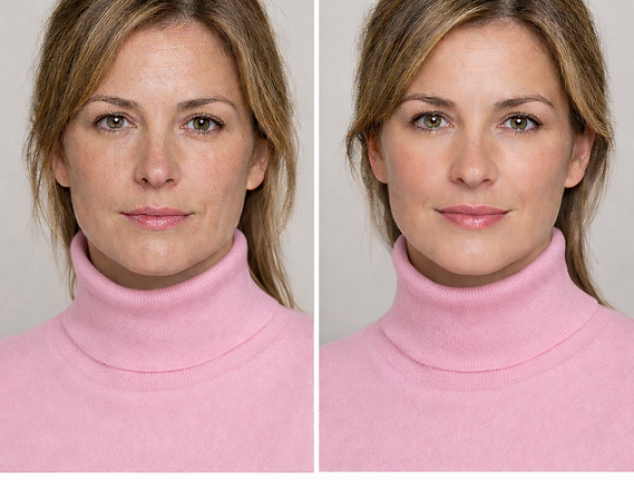 Skin Rejuvenation.png