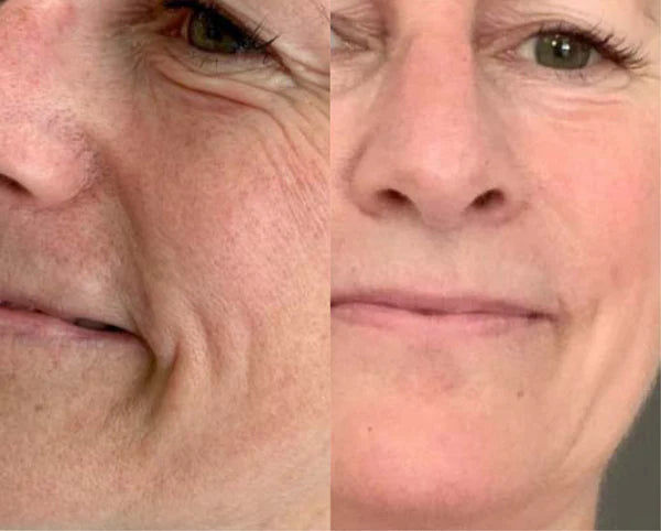 Thumbnail: RD COSMETIC Derma Collagen® Anti-Aging Regenerating Gel