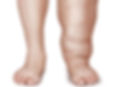 1hr Manual Lymphatic Drainage