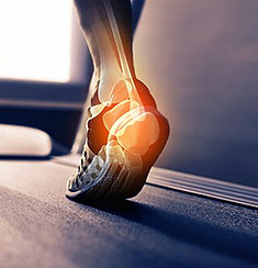 sports-injuries-s13-achilles-tendonitis.