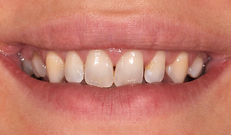 prima del trattamento