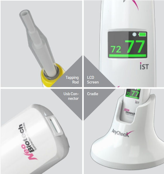 Thumbnail: AnyCheck – Implant Stability Meter