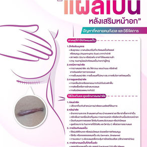 แผลเป็นหลังเสริมหน้าอก ป้องกันและดูแลอย่างไรให้ผิวเนียนสวย