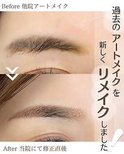 施術前と施術後の比較写真。施術前は眉やアイライン、リップなどの色味や形が薄く、施術後は自然で美しいアートメイクにより顔立ちが引き立っている様子。