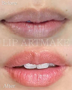 施 術前と施術後の比較