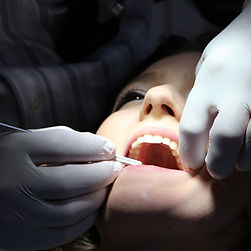 Imagem de próteses dentárias personalizadas em um modelo dental, destacando a solução para restaurar dentes ausentes