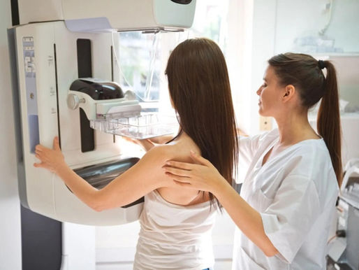 How to Prepare for Your Mammogram: The No-Deodorant Rule and Other Day-Of Tips
