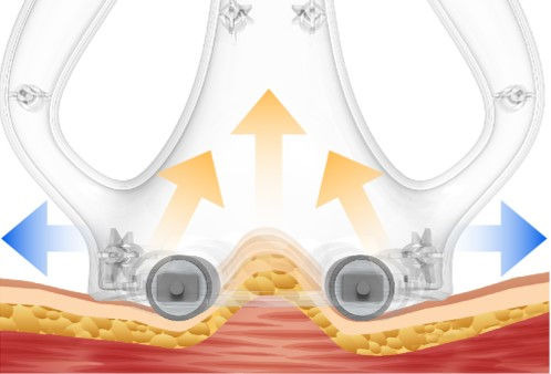ROLL RF VACUUM