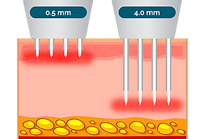 penetration depth_edited.png