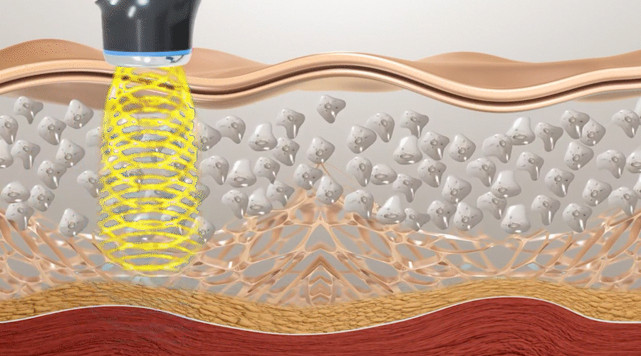 자사몰_HiSONIC.M 상세페이지 (ENG) 14.gif