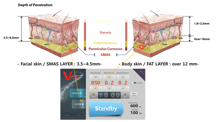 V-MAX PRESENTATION_1.png