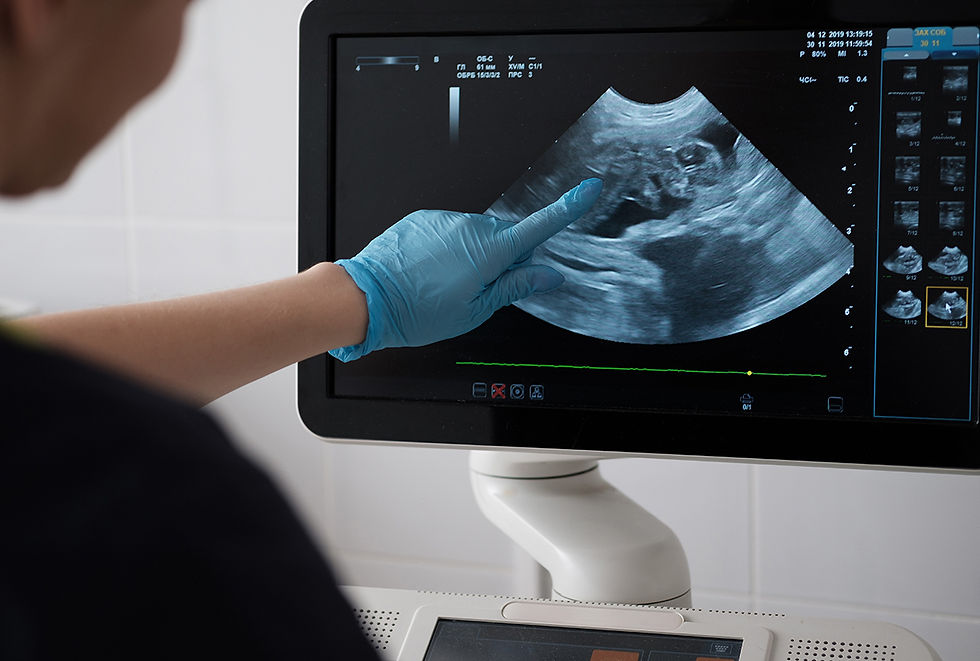 Close up of an ultrasound screen.