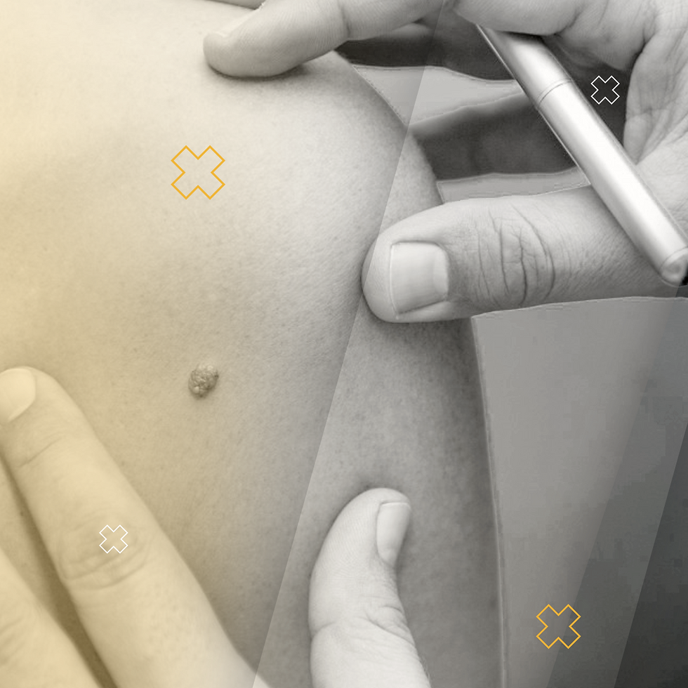 HIV Masterclass - HIV and the Skin