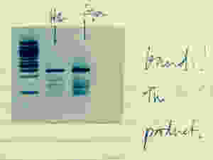 hairpin bisulfite PCR