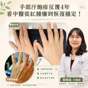 汗皰疹中醫治療