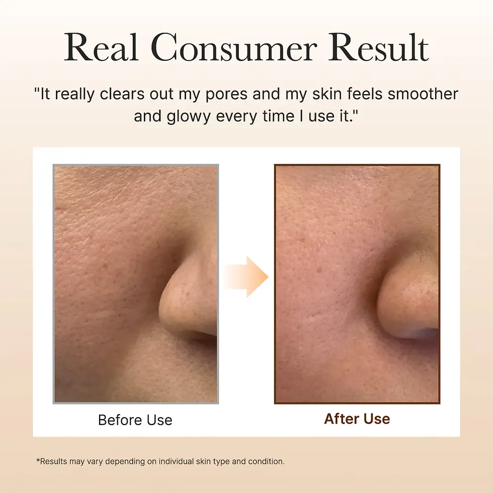 Thumbnail: Arencia Calendula Rice Mochi Cleanser, 120g