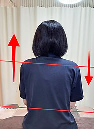 施術前のビフォー写真