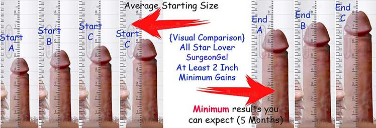 all-star-lover-surgeongel-results.jpg
