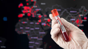 OMS lanza un plan para detener la propagación de la viruela símica