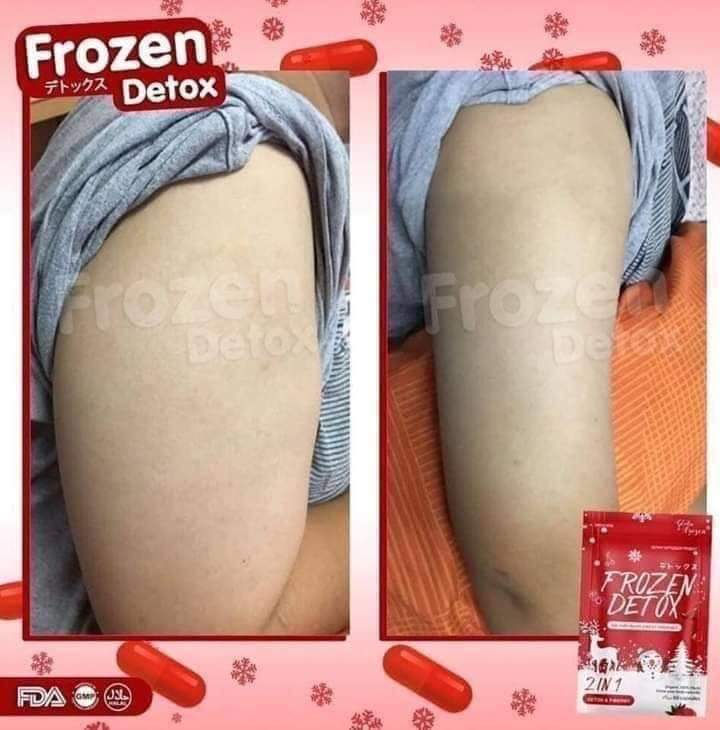 Thumbnail: FROZEN DETOX