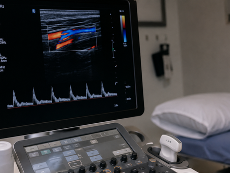 Ultrasonido Doppler: Qué Es, Para Qué Sirve y Por Qué es una Herramienta Clave en el Diagnóstico Médico