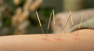 Immagine Ago 1_edited.jpg