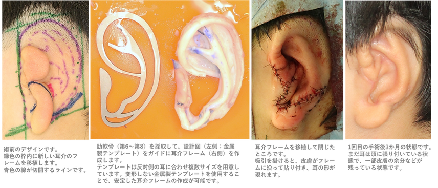 小児4.png