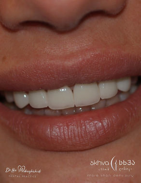 Harmonious Smile