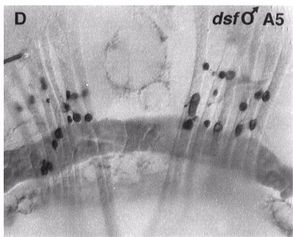 Sex Life Left You with Dissatisfaction? There’s a gene for that.