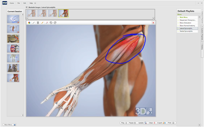 elbow pain