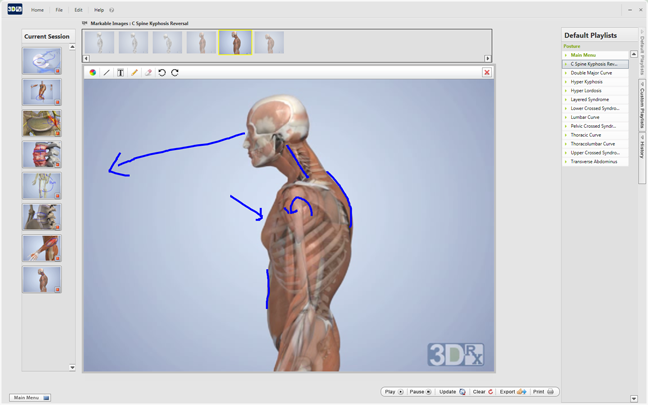 forward head posture