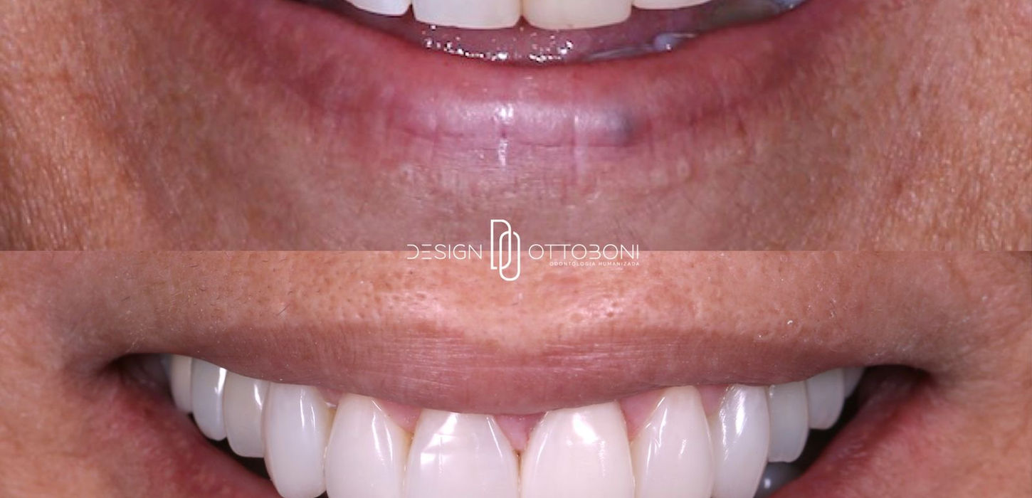 Serviço de estética resultado 2