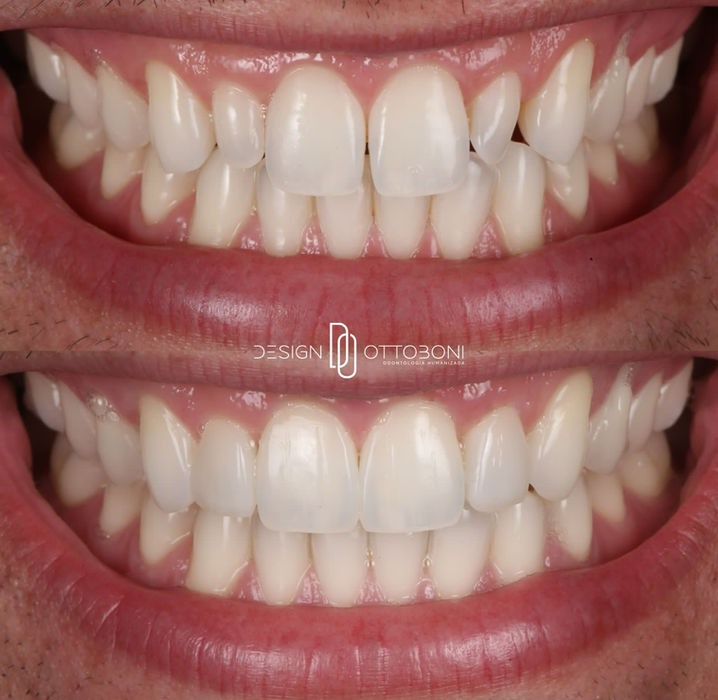 Serviço de estética resultado 1