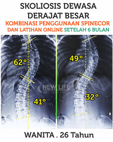 Pascahana Lintang.jpg