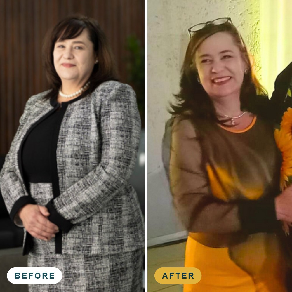 Weight loss