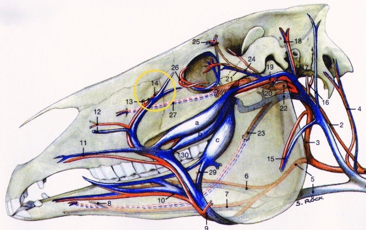 The major blood vessels of the head. Circled is one of the veins and accompanying artery that was freed up by adjusting the bone.