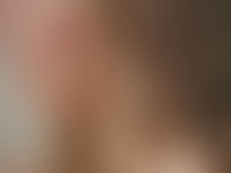 The Benefits of Microneedling with RejuvapenNXT for Skin Rejuvenation