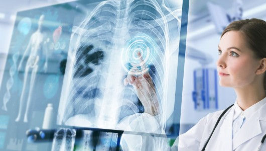 Thumbnail: Siemens Xograph 500mA X-ray 