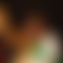 Tendonitis is not nice.  But we need to be nice to each other about it.  