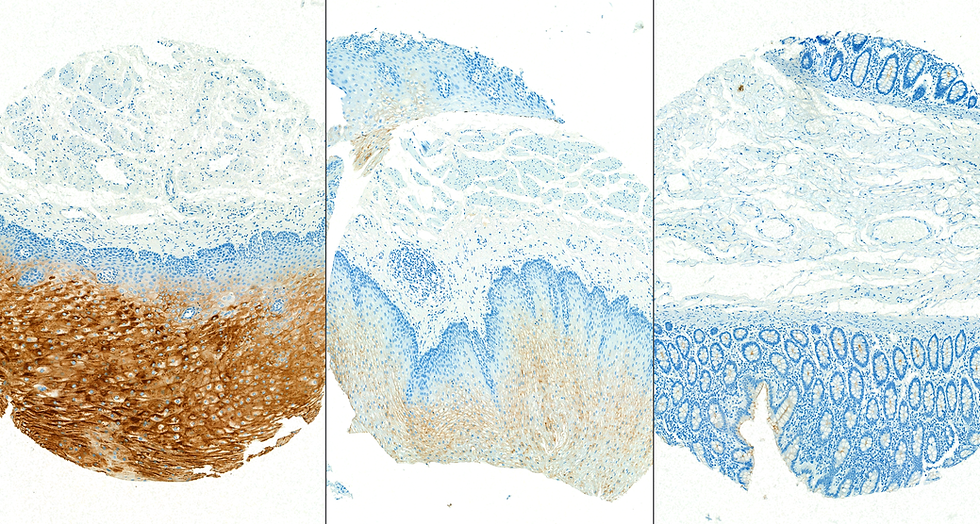 Figure B: Human Intestine. Comparative scoring; high, medium, low.