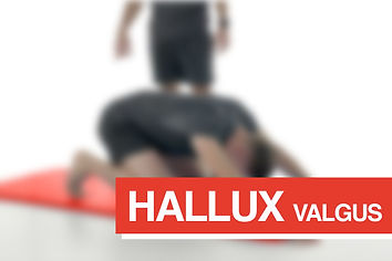 HALLUX VALGUS.jpg