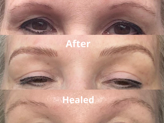 Why did my microblading disappeared?