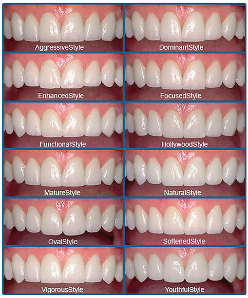 Smile Design | LVI Smile Catalog | Cosmetic Dentistry Styles