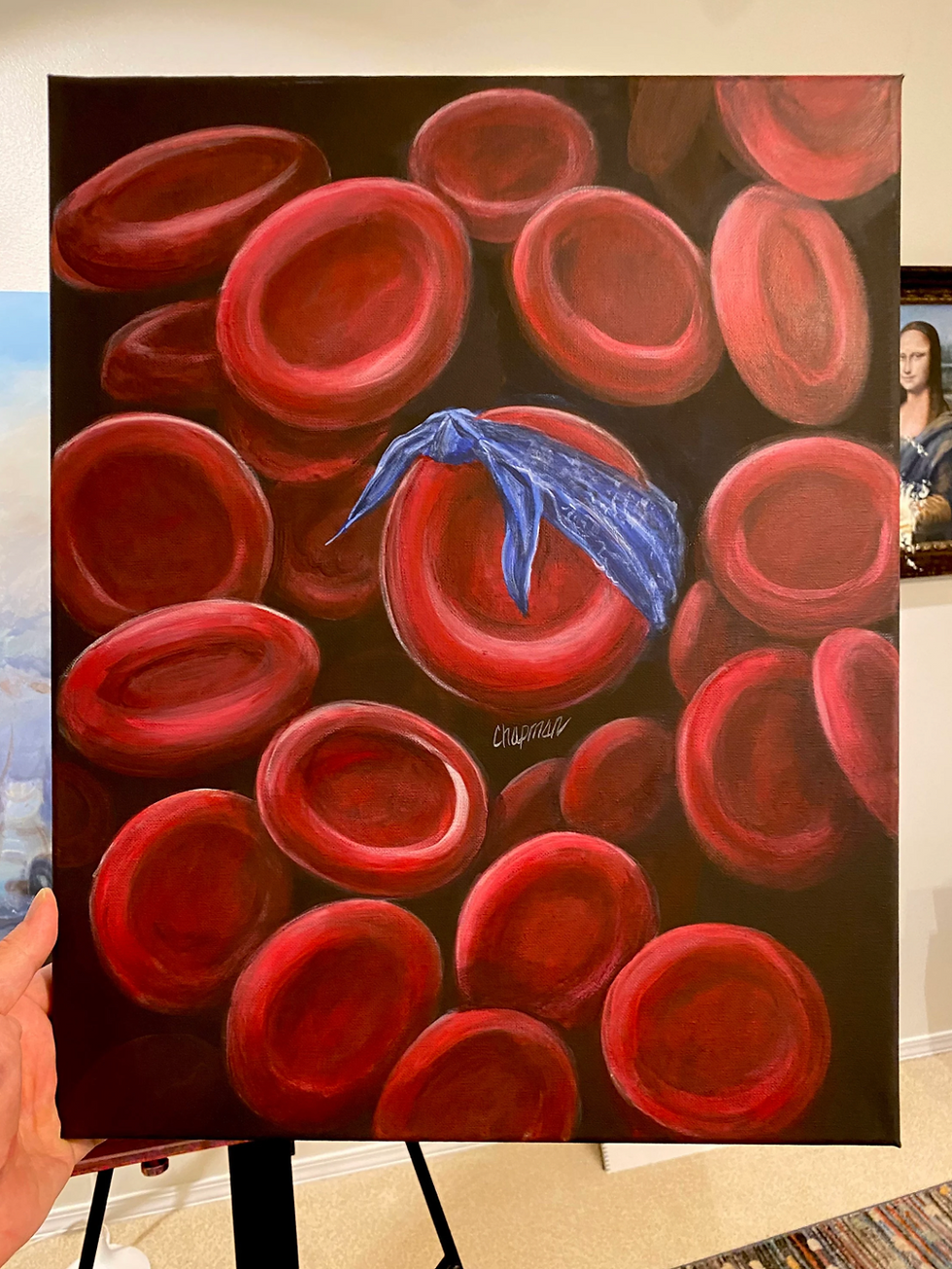 Thumbnail: Red blood cell with a blue crip bandanna Stretched canvas