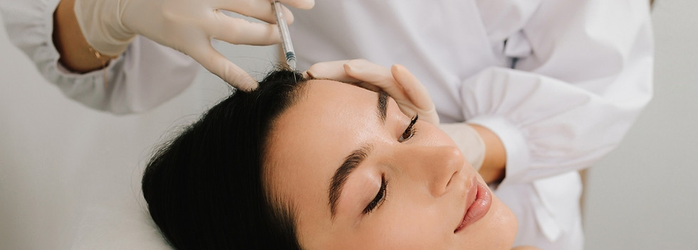Scalp Microneedling