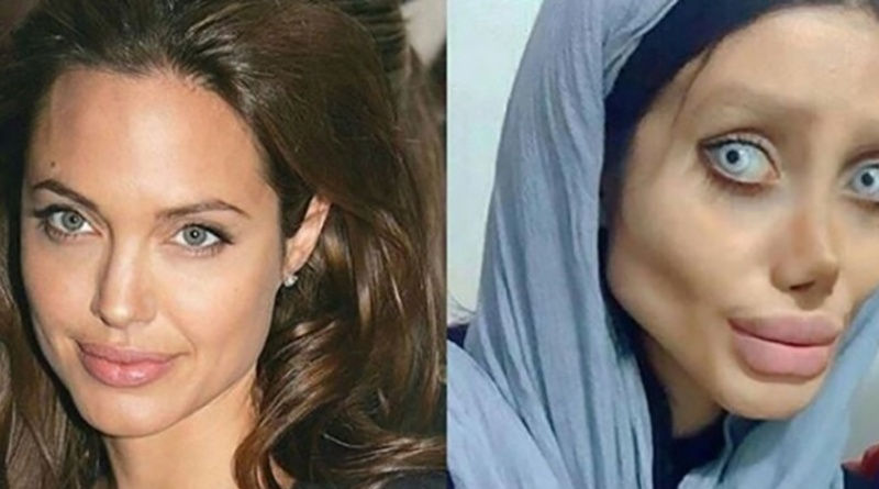 Sahar Tabar, la joven que se ha realizado 50 cirugías para parecerse a Angelina Jolie